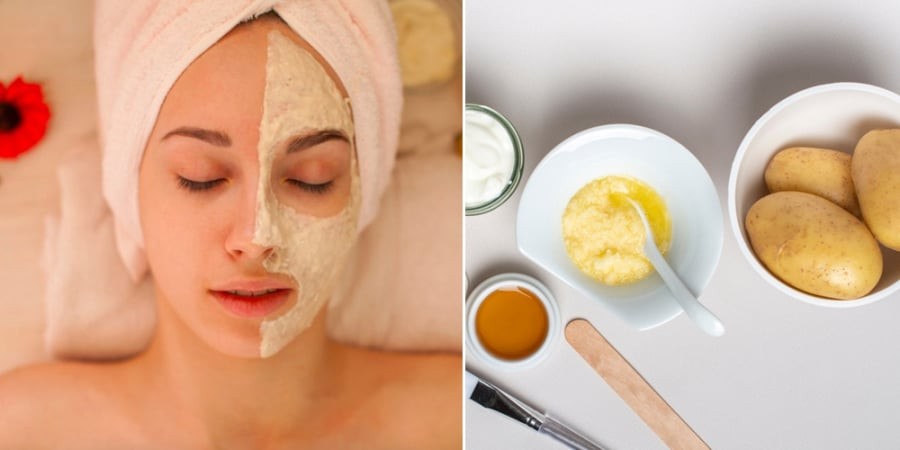 Trong khoai tây có nhiều vitamin và khoáng chất giúp làm sạch da, giảm bã nhờn và hỗ trợ cải thiện tình trạng mụn.