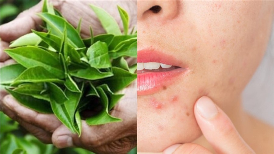 Nhờ hàm lượng polyphenol cao, trà xanh có thể giúp giảm tác động từ tia UV và ô nhiễm – những yếu tố góp phần gây lão hóa sớm. 