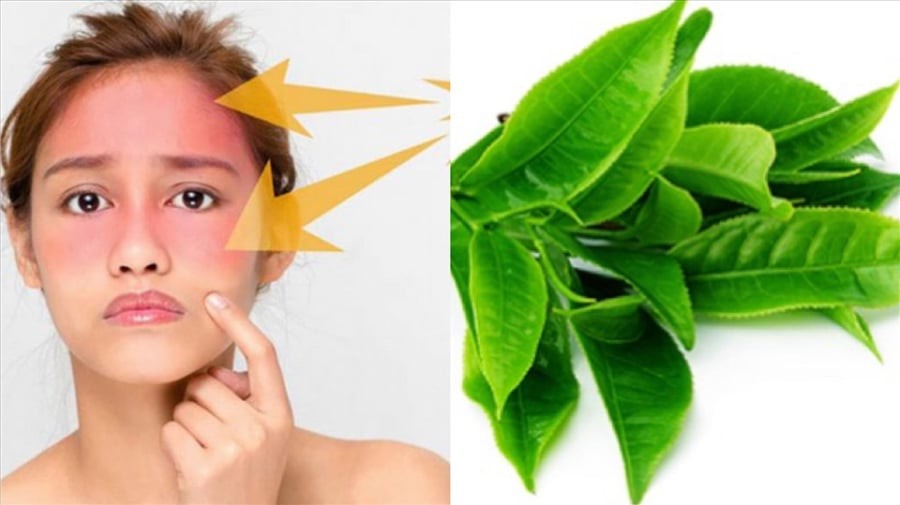 Đặc tính kháng viêm của trà xanh giúp làm dịu các vùng da bị kích ứng hoặc đỏ rát. 