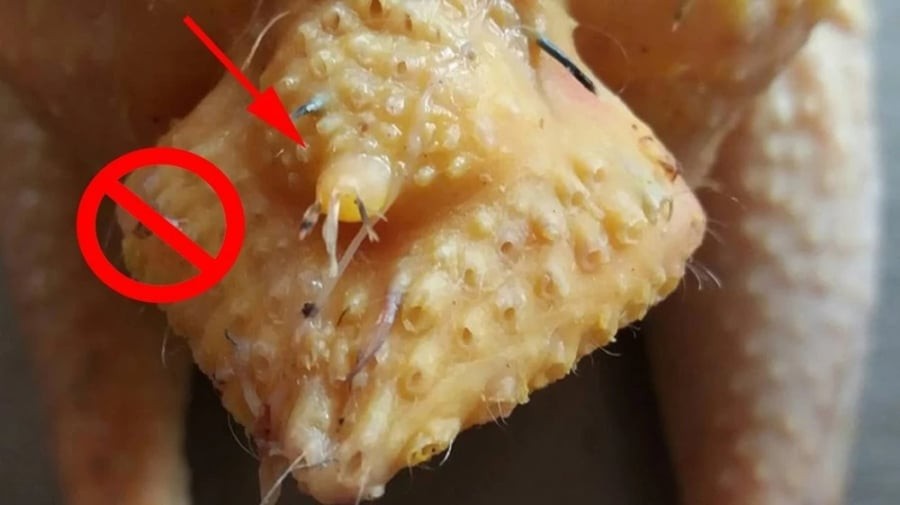 Phao câu gà (hay còn gọi là đuôi gà) là phần mà rất nhiều người yêu thích vì cho rằng béo, giòn và đậm đà. Tuy nhiên, đây lại là một trong những bộ phận bị cảnh báo nhiều nhất.

