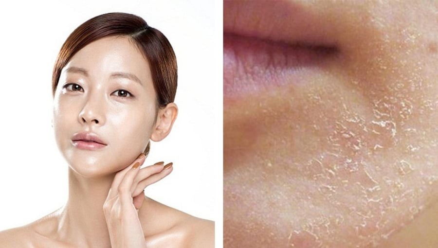 Đây là một trong những nguyên nhân phổ biến khiến diện mạo trông già đi nhanh chóng.