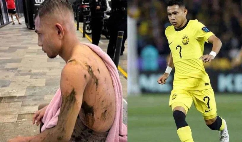 Tuyển thủ Malaysia nguy cơ giải nghệ vì bị tạt axit, Indonesia nổi điên vị trọng tài Thái Lan dự Olympic - Bóng Đá