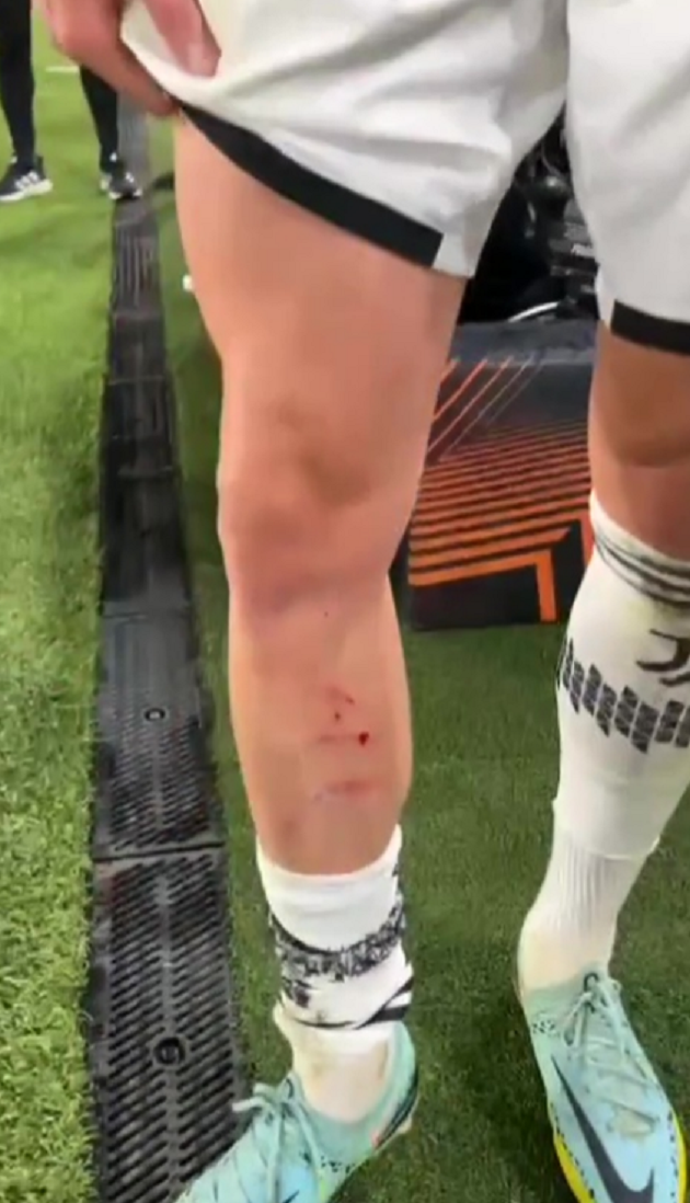 Official: Milan confirm Gabbia’s return - Bóng Đá