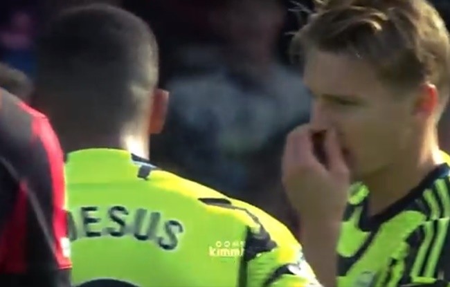 Kevin de Bruyne hồi phục  - Bóng Đá