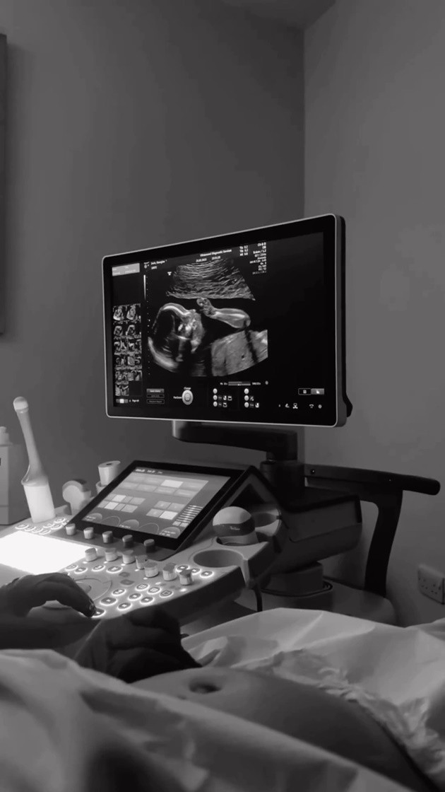 10 most expensive goalkeepers in Premier League - Bóng Đá