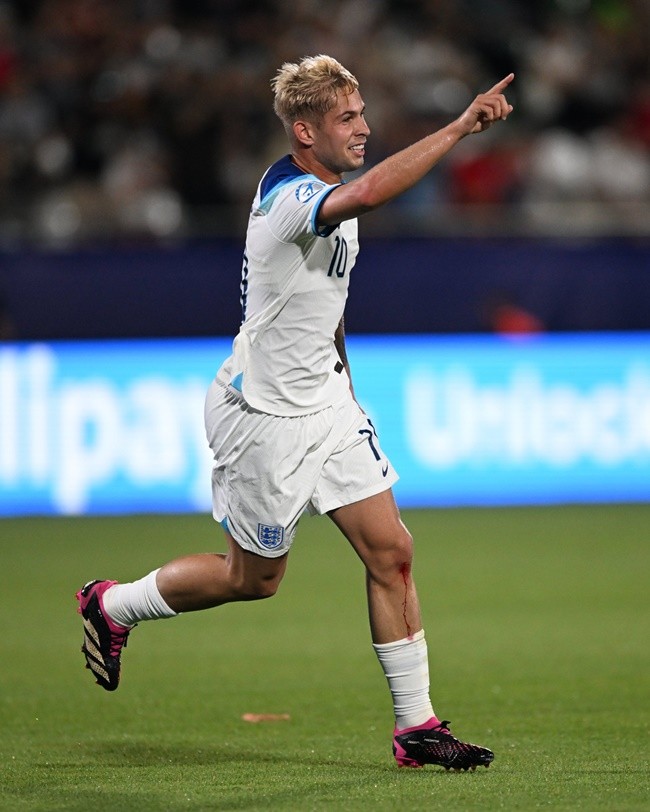 Sự bùng nổ bất ngờ mang cho Arteta cơn đau đầu - Bóng Đá