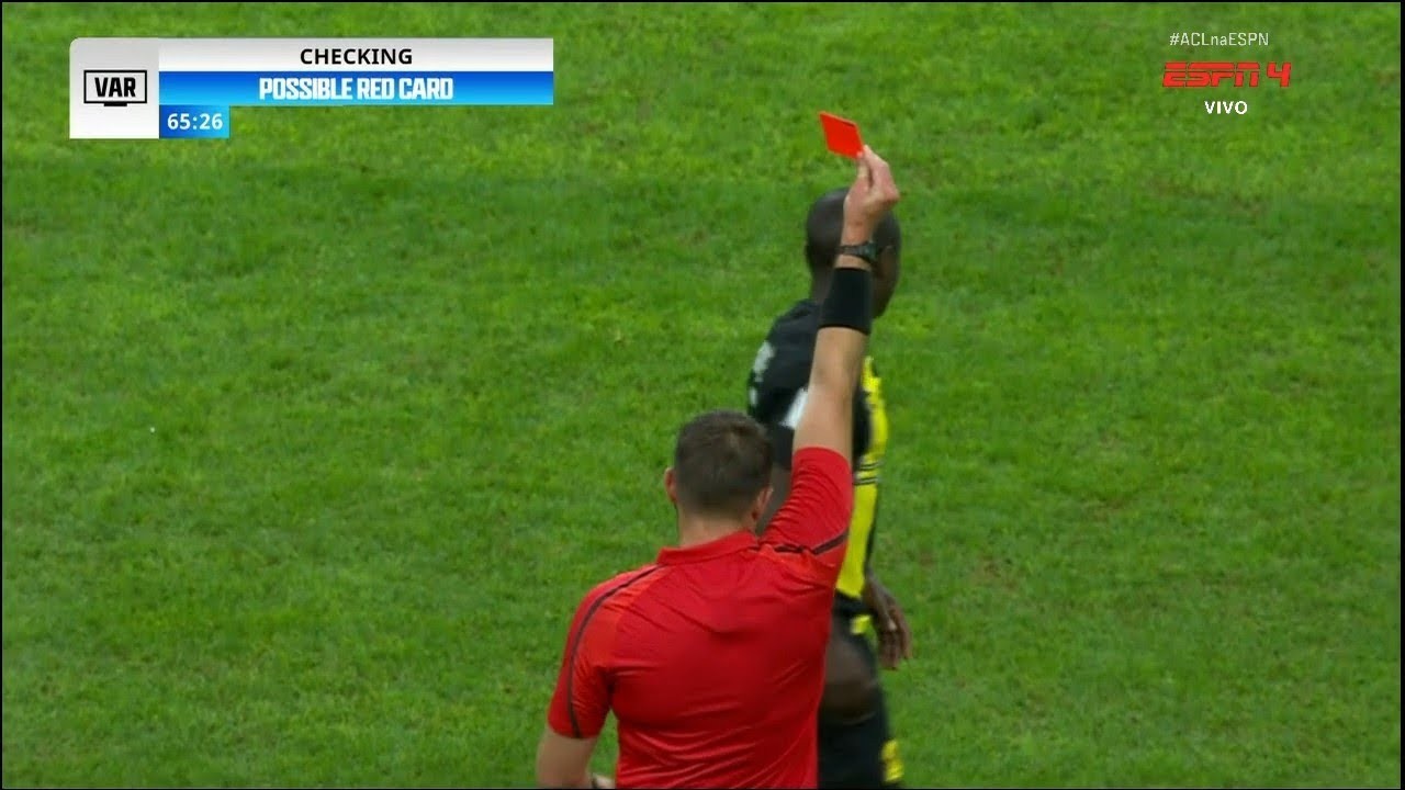 Buồn của N'Golo Kante - Bóng Đá