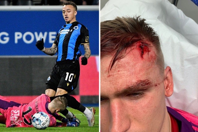 Thủ thành Arsenal va chạm cực mạnh, phải vào viện điều trị - Bóng Đá