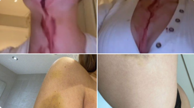 Greenwood hành hạ bạn gái - Bóng Đá