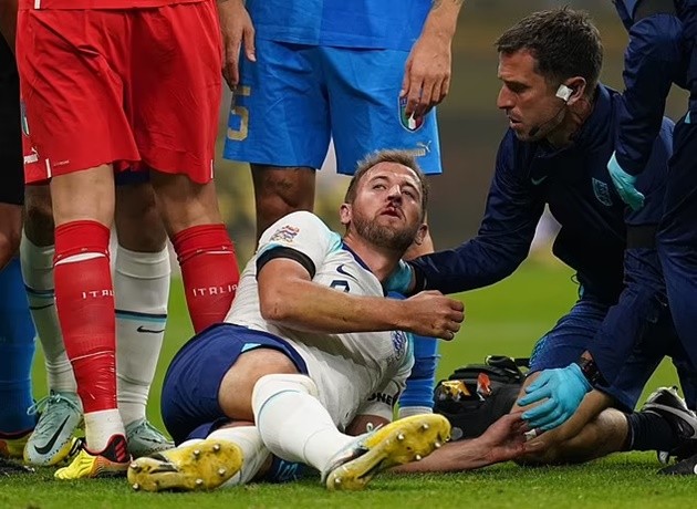 Kane bê bết máu gục trên sân - Bóng Đá