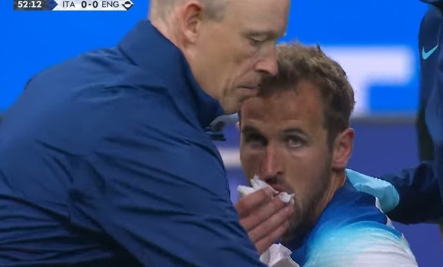 Cú volley hoàn hảo khiến Ronaldo phải ngã mũ - Bóng Đá