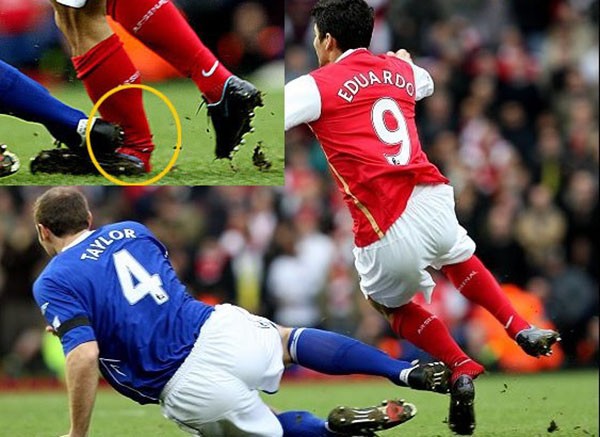 Hùng Dũng và những cầu thủ bị gãy gập ống đồng của bóng đá Thế giới - Bóng Đá