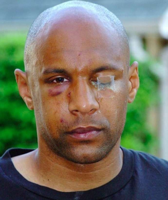 Sterling - Gomez và những cuộc ẩu đả trên sân tập nổi tiếng - Bóng Đá