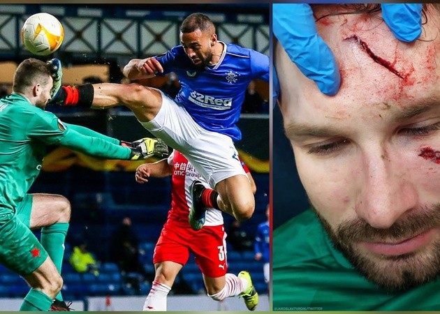 SỐC! 'Tung cước' kinh hoàng, học trò của Gerrard khiến đối thủ đổ máu - Bóng Đá