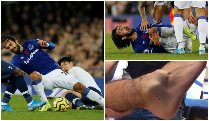 SỐC! Son Heung-min đạp gãy chân cựu sao Barca, khóc ngất rời sân - Bóng Đá