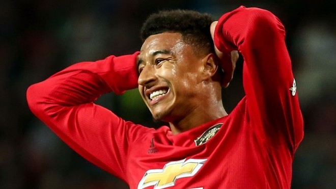 Những vấn đề Man United cần giải quyết trước derby Manchester - Bóng Đá
