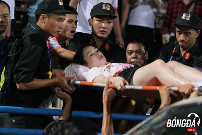 Báo châu Á nói 1 điều về sự cố pháo sáng gây thương tích ở Hàng Đẫya - Bóng Đá