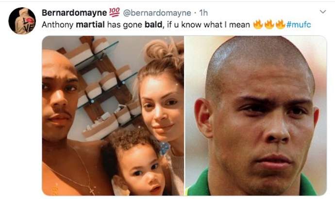 Man Utd star Anthony Martial baffles fans with bold new look - Bóng Đá