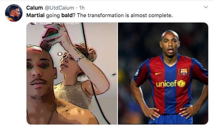 Man Utd star Anthony Martial baffles fans with bold new look - Bóng Đá