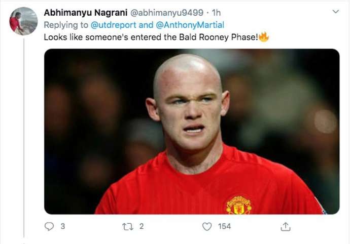 Man Utd star Anthony Martial baffles fans with bold new look - Bóng Đá