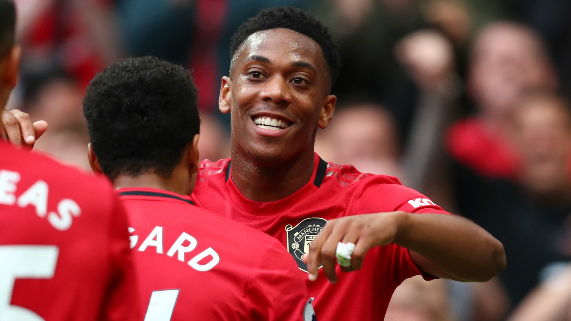Man Utd star Anthony Martial baffles fans with bold new look - Bóng Đá