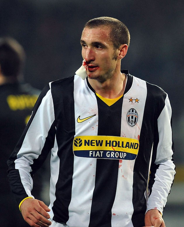 Laurent Blanc said to offer himself as an 'interim' to replace Setien at Barca - Bóng Đá