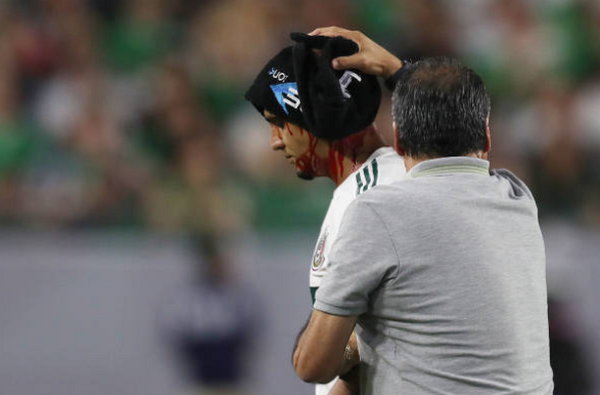 Haiti vs Mexico - Bóng Đá