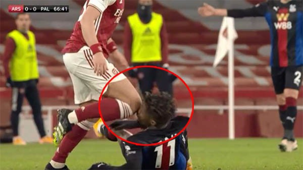 David Luiz cục súc, 