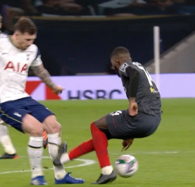 Bài ảnh chấn thương rùng rợn của Pierre-Emile Hojbjerg - Bóng Đá