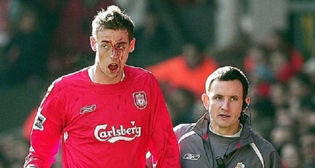 PETER CROUCH: There isn’t a bigger fixture than Liverpool against Manchester United...and I've got the scar from the FA Cup fifth round tie - Bóng Đá