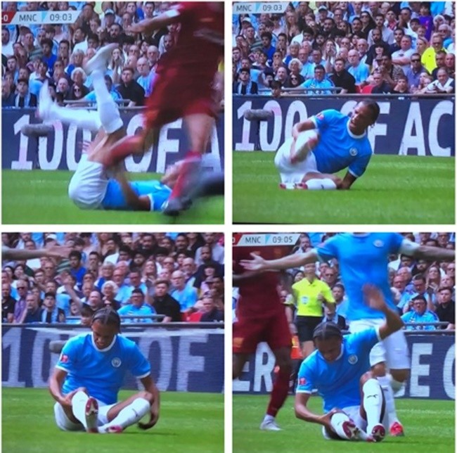 Guardiola on Sane’s injury: “I think he will be okay.” - Bóng Đá