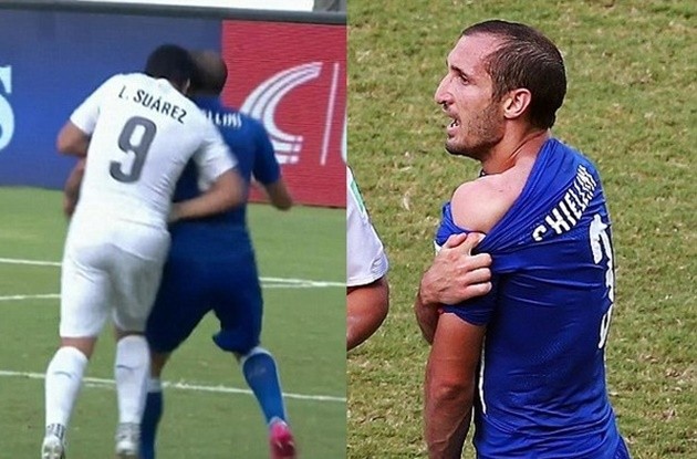 Man Utd loanee banned for six games after alleged biting incident - Bóng Đá