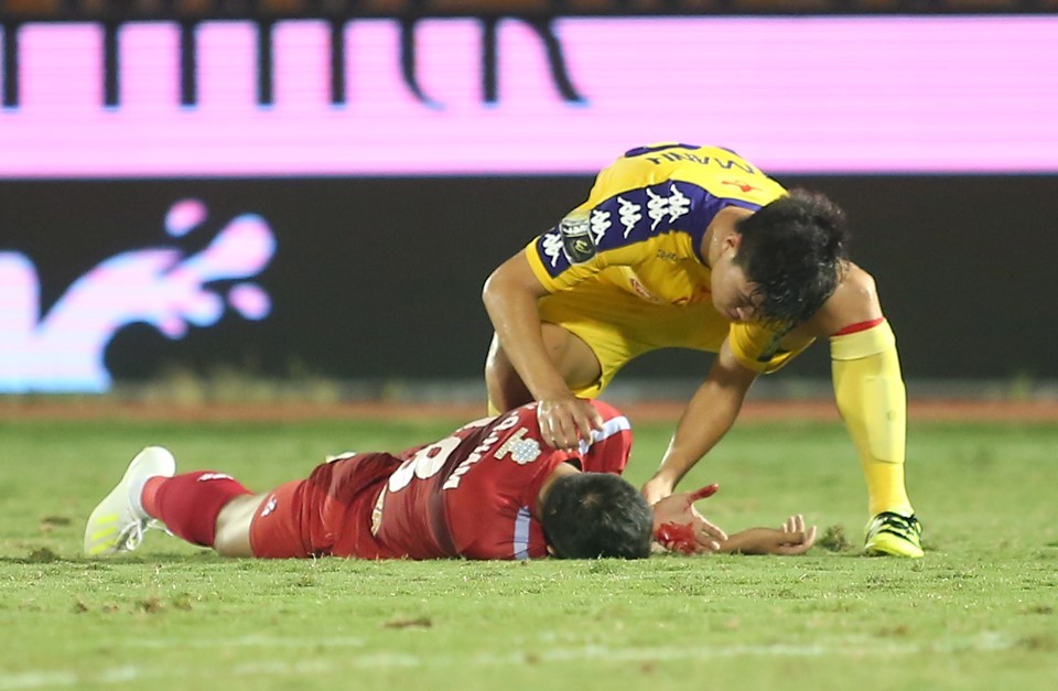 Máu, nước mắt và trận cầu đẳng cấp quốc tế - Bóng Đá