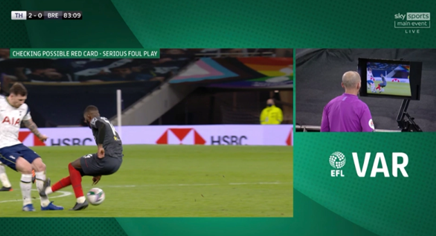 Bài ảnh chấn thương rùng rợn của Pierre-Emile Hojbjerg - Bóng Đá