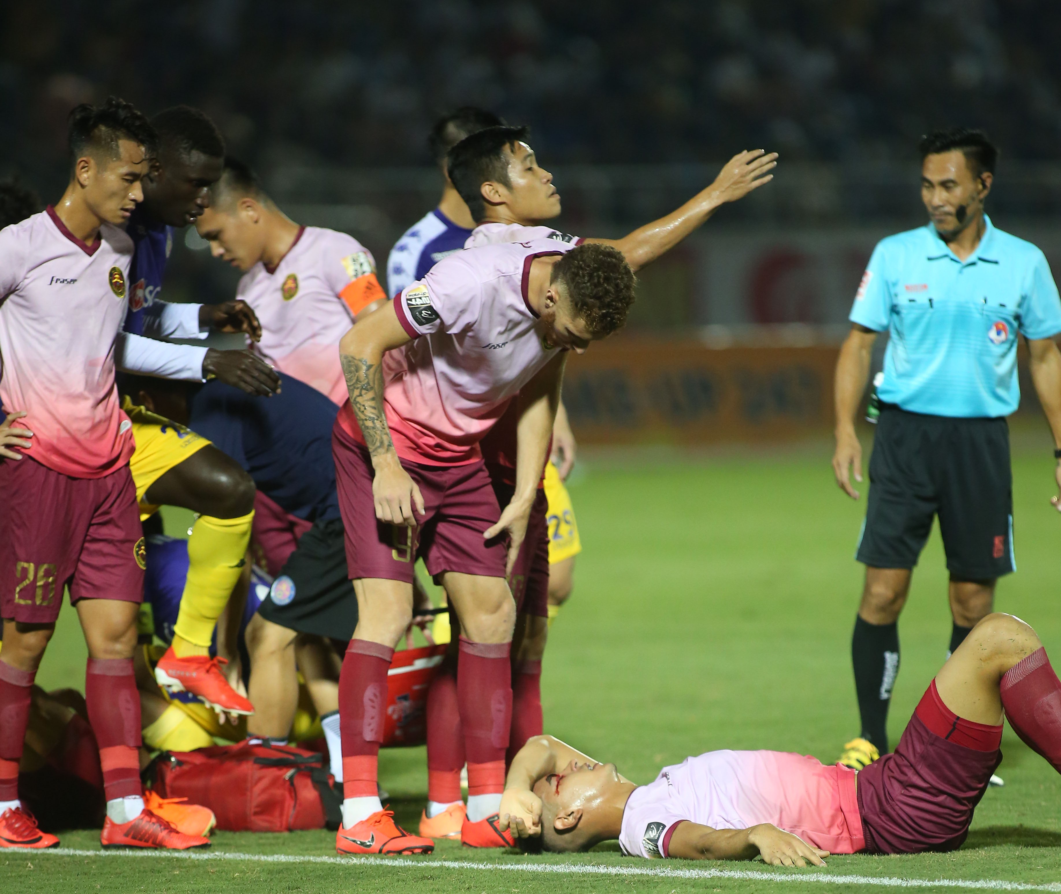 Rạn xương má, có máu tụ Đức Lợi nhập viện khẩn cấp - Bóng Đá