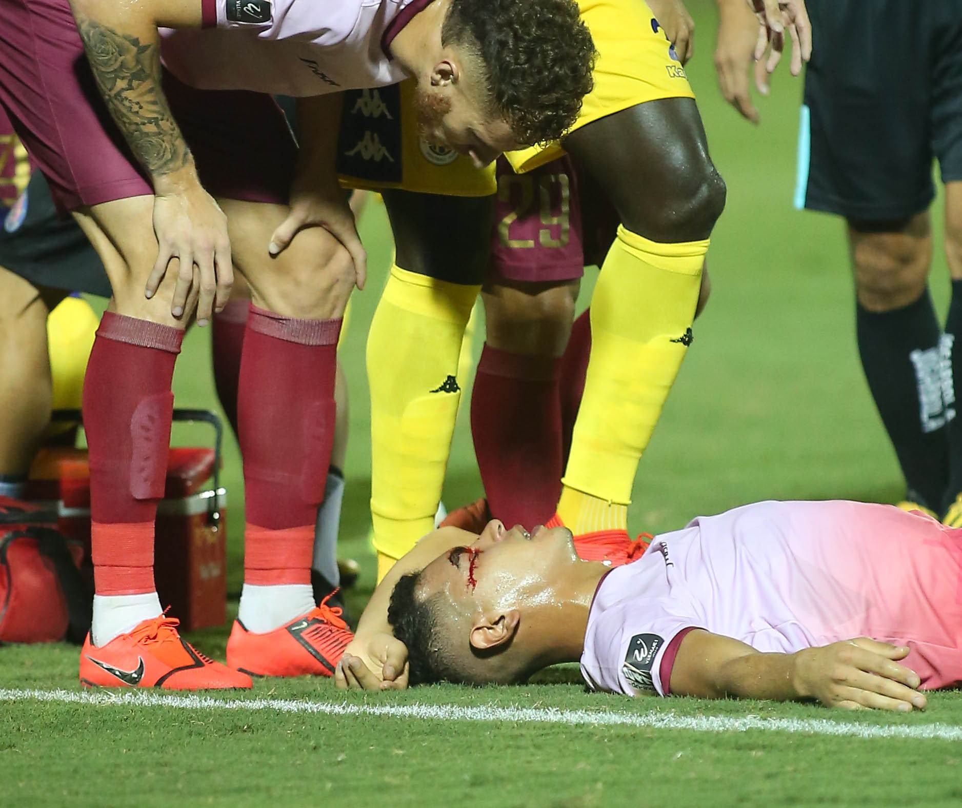 Rạn xương má, có máu tụ Đức Lợi nhập viện khẩn cấp - Bóng Đá