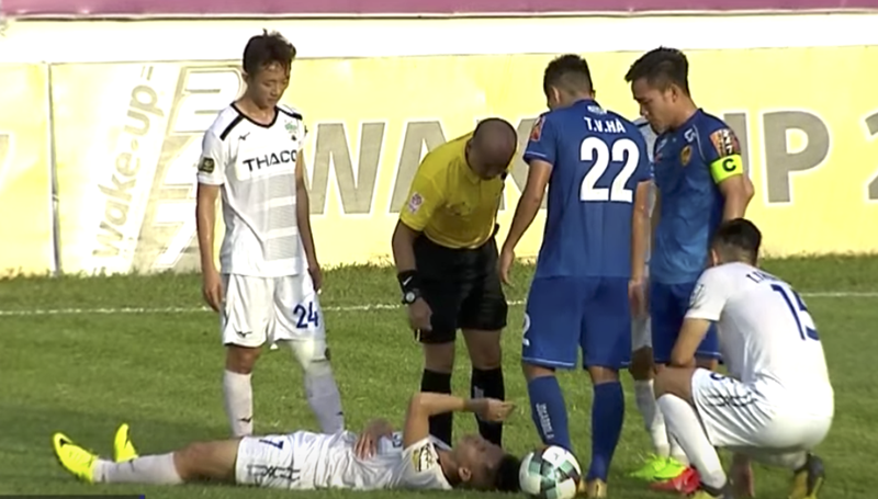 Hồng Duy không bị gãy xương, chỉ chấn thương phần mền không quá nặng - Bóng Đá