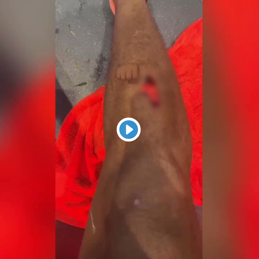 Manchester United: Fans are enjoying Anthony Martial footage following derby win - Bóng Đá