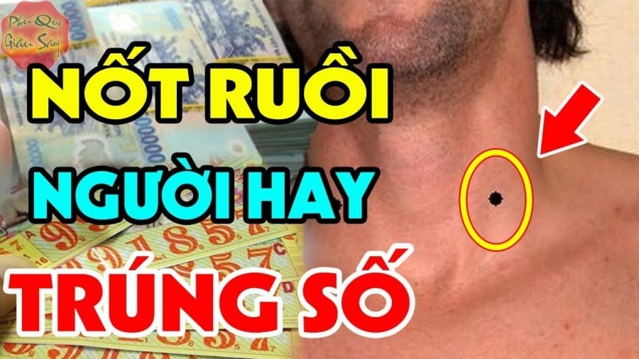 Nốt ruồi may mắn giàu có