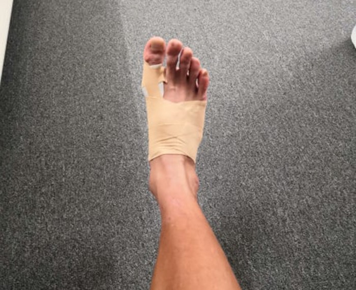 Đã rõ mức độ chấn thương của ứng viên thay thế Đình Trọng ở U22 Việt Nam (Khắc Vũ) - Bóng Đá