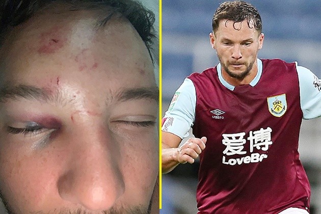 The fall of Danny Drinkwater: From Premier League winner to £35m flop not fit for Chelsea's bench. - Bóng Đá