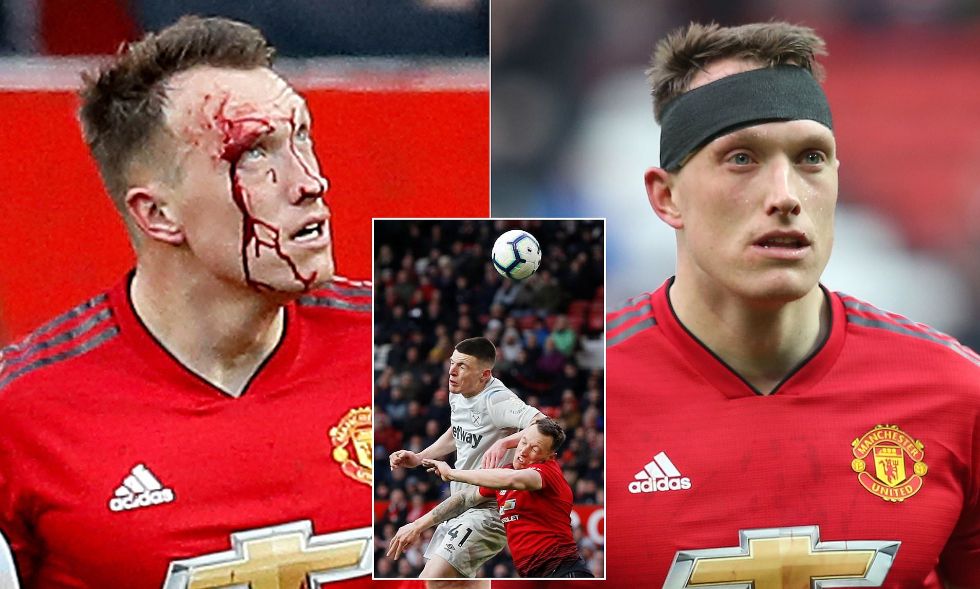 Phil Jones 'đổ máu' là điều cần thiết với Man Utd thời điểm này - Bóng Đá