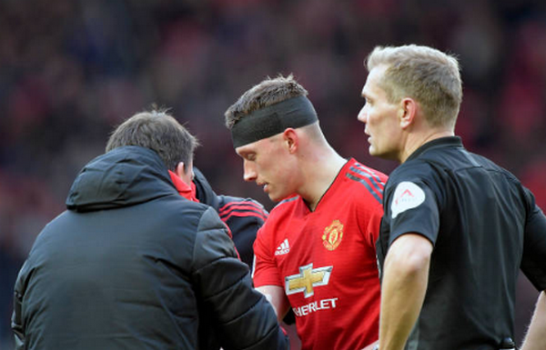 Declan Rice khiến Phil Jones đổ máu - Bóng Đá