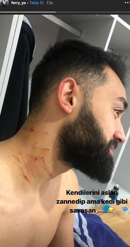 Sốc: Cầu thủ bị đối thủ dùng dao cứa cổ ngay trên sân - Bóng Đá