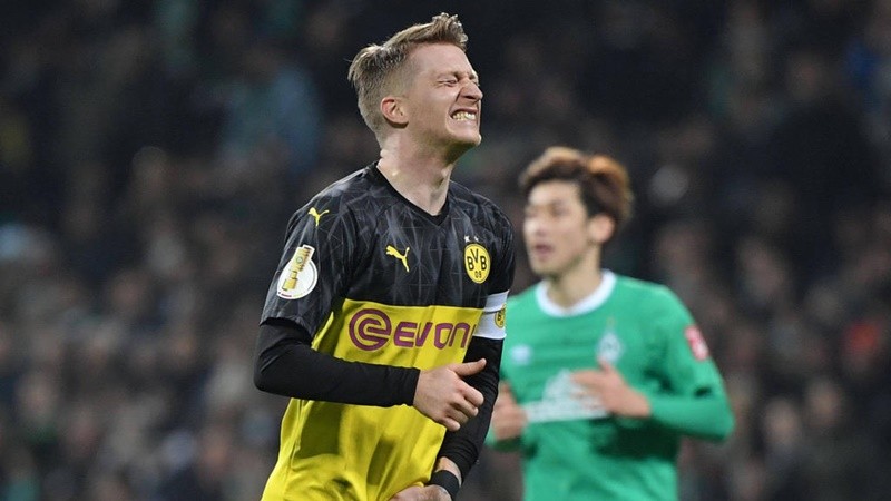 Marco Reus out injured 4 weeks - Bóng Đá