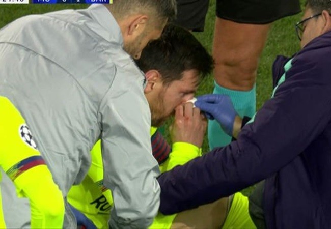 Smalling khiến Messi đổ máu ở Old Trafford - Bóng Đá