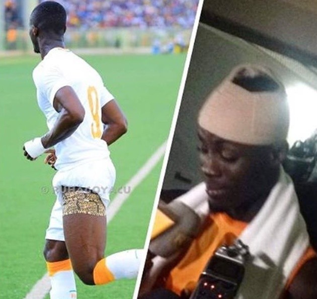 Bailly mặc số 9, ghi bàn rồi bất tỉnh trên tuyển - Bóng Đá