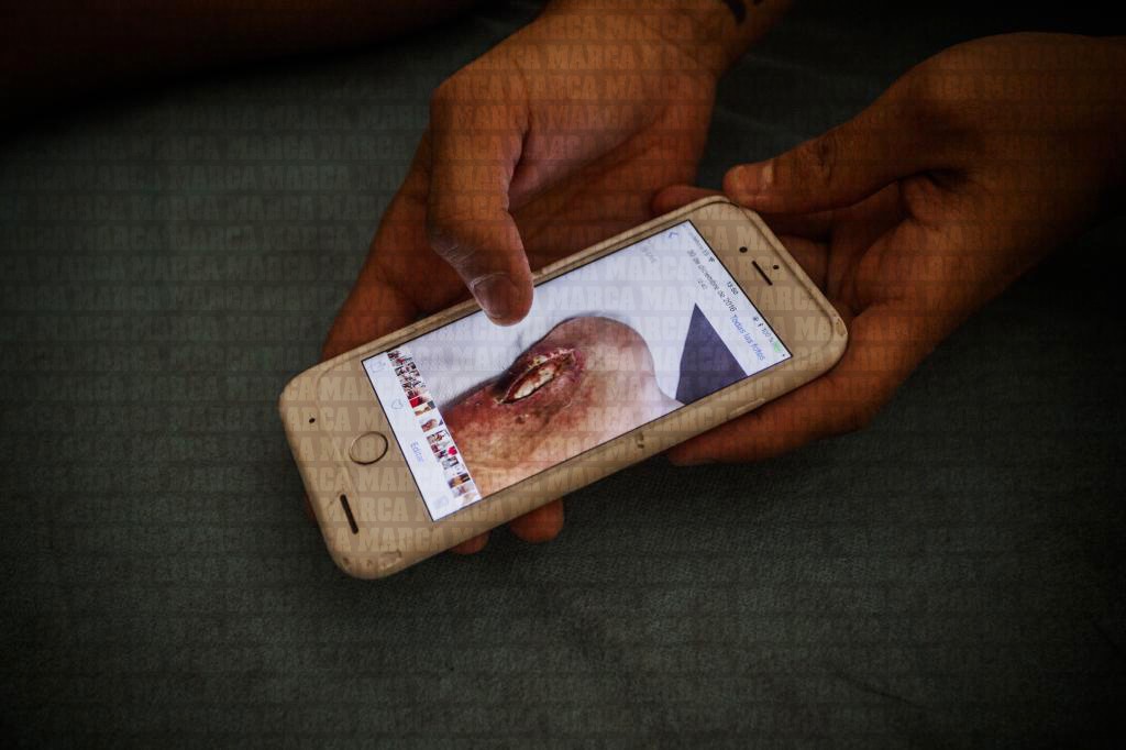 Cazorla trải lòng về chấn thương: Tôi đi lại được đã là may mắn - Bóng Đá