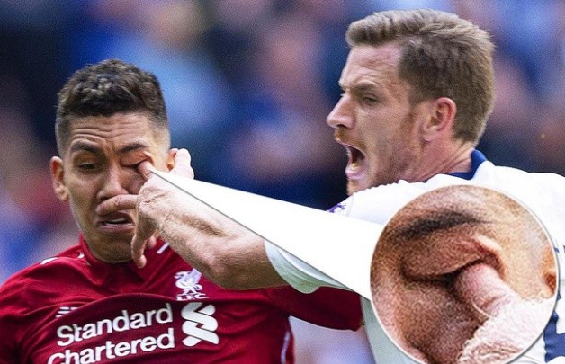 3 điều 'quan trọng' Klopp cần đưa ra quyết định trước trận PSG - Bóng Đá