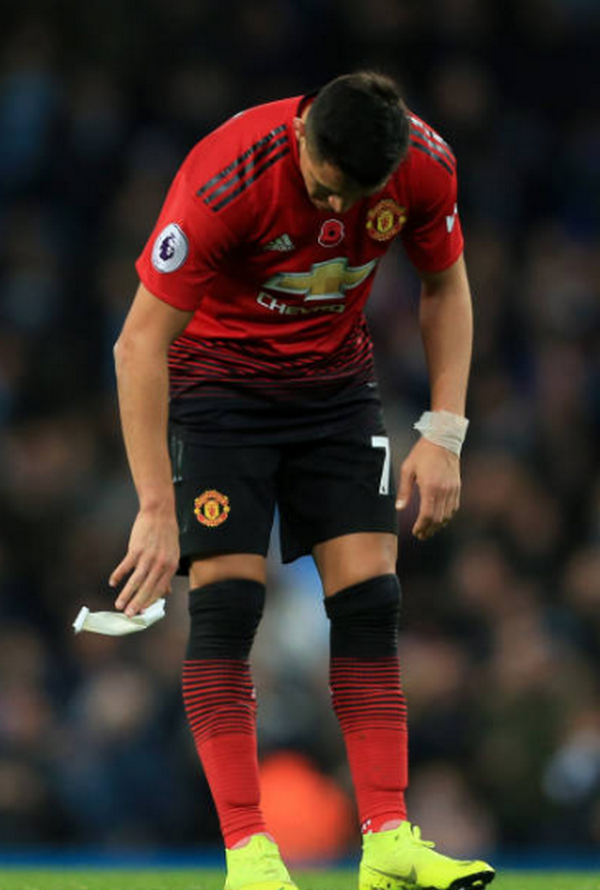 Thua trận, Man United còn phải đau đầu với hình ảnh này (Sanchez ôm chân) - Bóng Đá